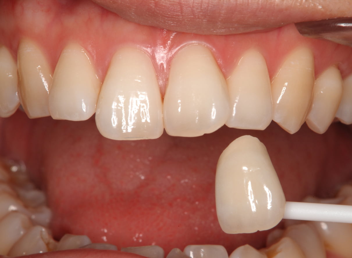 歯科領域でのカラーマネジメントシステム