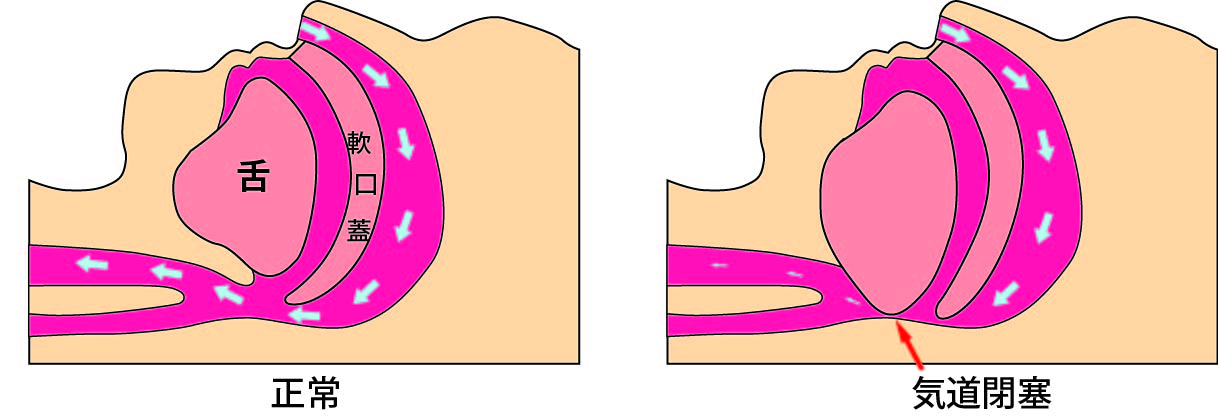 図1