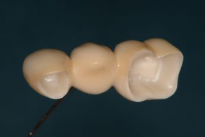 図2-b